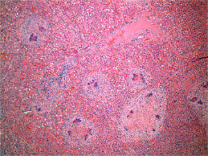 Foto 2: Uitstrijkje van de lever met multifocaal necrotische haarden, met centraal de coccoide bacteriën (L. Begeman, DWHC)