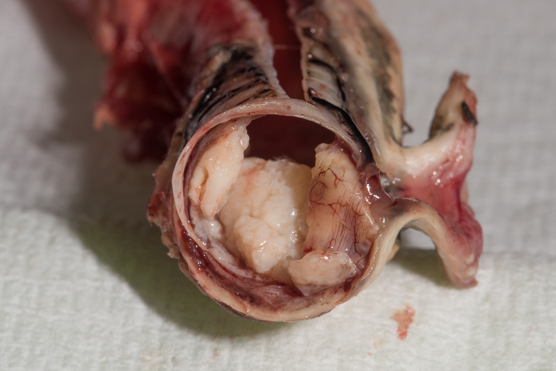 foto trachea met ontsteking